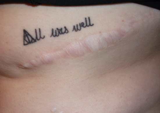 What are cancer survivor tattoos?