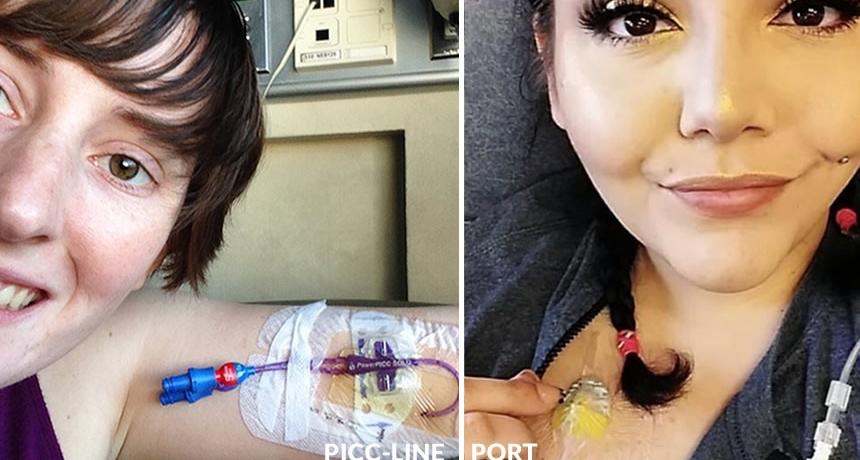 What To Know About PICC Lines and Ports | Cancer 101 |... What To Know About PICC Lines and Ports | Cancer 101 |...